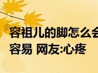 容祖儿的脚怎么会这样？看来天后真的没那么容易 网友:心疼