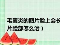 毛囊炎的图片脸上会长毛囊炎吗?地图至青北妙（毛囊炎图片脸部怎么治）