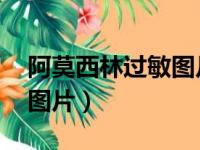 阿莫西林过敏图片 红疹（阿莫西林过敏症状图片）